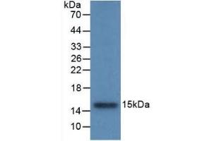 Detection of Recombinant CSTB, Rat using Monoclonal Antibody to Cystatin B (CSTB) (CSTB Antikörper  (AA 2-98))