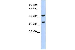 Western Blotting (WB) image for anti-Ankyrin Repeat and SOCS Box Containing 8 (ASB8) antibody (ABIN2459530) (ASB8 Antikörper)
