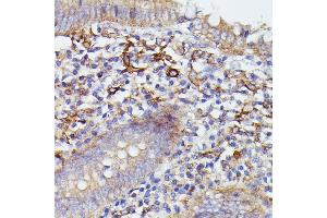 Immunohistochemistry of paraffin-embedded human appendix using SN antibody (ABIN7270670) at dilution of 1:100 (40x lens).