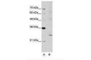 Image no. 3 for anti-Exosome Component 4 (EXOSC4) (N-Term) antibody (ABIN202117) (EXOSC4 Antikörper  (N-Term))
