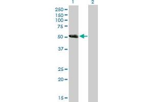 Western Blot analysis of DKFZP779L1558 expression in transfected 293T cell line by DKFZP779L1558 MaxPab polyclonal antibody. (CCDC91 Antikörper  (AA 1-411))