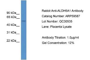 WB Suggested Anti-ALDH5A1  Antibody Titration: 0.