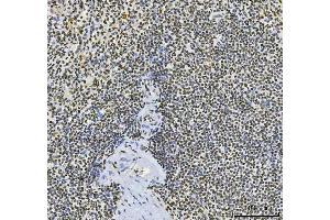 IHC analysis of CPSF6 using anti-CPSF6 antibody (ABIN7601897).