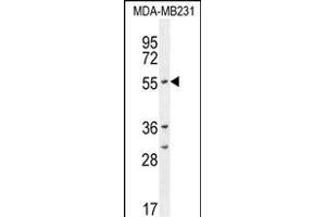 CYP2A7 Antibody (Center) (ABIN654434 and ABIN2844170) western blot analysis in MDA-M cell line lysates (35 μg/lane).