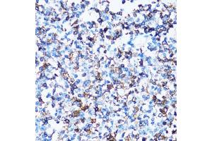 Immunohistochemistry (Paraffin-embedded Sections) (IHC (p)) image for anti-Sialophorin (SPN) (AA 276-400) antibody (ABIN6148363)