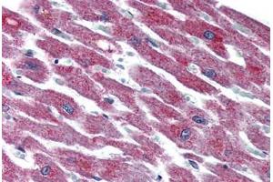 Heart, Human: Formalin-Fixed, Paraffin-Embedded (FFPE) (ADCYAP1R1 Antikörper  (N-Term))