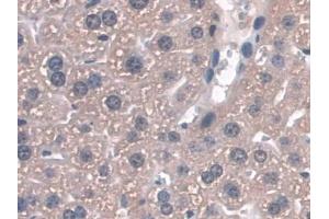 Immunohistochemistry (IHC) image for anti-Glutathione Peroxidase 3 (Plasma) (GPX3) (AA 3-72) antibody (ABIN7443332)