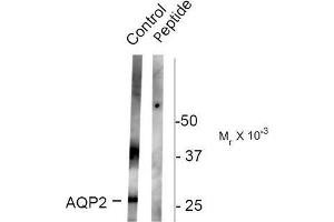 Image no. 1 for anti-Aquaporin 2 (Collecting Duct) (AQP2) (pSer261) antibody (ABIN372590) (AQP2 Antikörper  (pSer261))