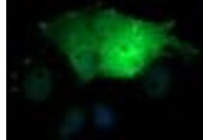 Image no. 9 for anti-SEC14 and Spectrin Domains 1 (SESTD1) antibody (ABIN1501066)