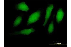 Immunofluorescence of purified MaxPab antibody to RNF34 on HeLa cell. (RNF34 Antikörper  (AA 1-373))