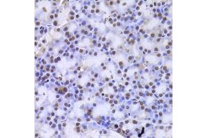 Immunohistochemistry of paraffin-embedded rat pancreas using CSNK1E Antibody. (CK1 epsilon Antikörper)