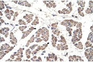 Immunohistochemical staining (Formalin-fixed paraffin-embedded sections) of human muscle with GCDH polyclonal antibody  at 4-8 ug/mL working concentration. (GCDH Antikörper  (C-Term))