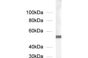 dilution: 1 : 1000, sample: rat brain homogenate (alpha Tubulin Antikörper  (AA 419-435))