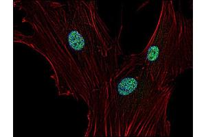 Immunofluorescence staining of p21 in human primary fibroblasts using anti-p21 (; green).