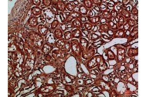 Immunohistochemical analysis of paraffin-embedded Human-kidney, antibody was diluted at 1:100 (EYA1 Antikörper)