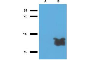 Western blotting analysis of polyclonal anti-Mycobacterium tuberculosis antigen Tb7. (Mycobacterium Tuberculosis Antigen Tb7.7 Antikörper)