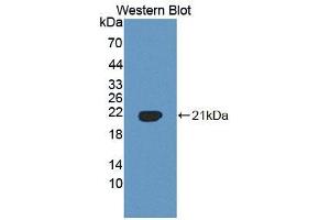 Western blot analysis of the recombinant protein. (PLSCR3 Antikörper  (AA 99-253))