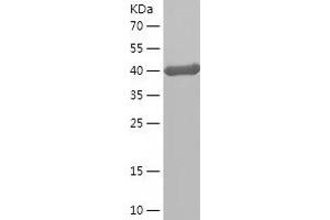 Western Blotting (WB) image for TAR DNA Binding Protein (TARDBP) (AA 8-192) protein (His-IF2DI Tag) (ABIN7125315)