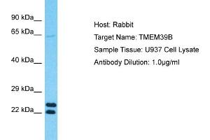 Host: Rabbit Target Name: TMEM39B Sample Type: U937 Whole Cell lysates Antibody Dilution: 1. (TMEM39B Antikörper  (N-Term))