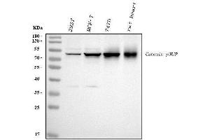 Western blot analysis of gamma Catenin using anti-gamma Catenin antibody (ABIN3043864). (JUP Antikörper  (AA 556-745))