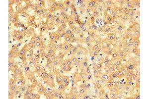 Immunohistochemistry of paraffin-embedded human liver tissue using ABIN7168546 at dilution of 1:100