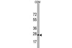 Western blot analysis of BarX1 Antibody (C-term) in CEM cell line lysates (35 μg/lane). (BARX1 Antikörper  (C-Term))