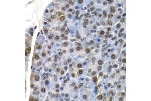 Immunohistochemistry of paraffin-embedded mouse pancreas using ID3 antibody at dilution of 1:200 (400x lens). (ID3 Antikörper)