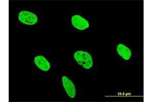 Immunofluorescence (IF) image for anti-Runt-Related Transcription Factor 2 (RUNX2) (AA 251-350) antibody (ABIN514045)