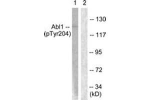 Western blot analysis of extracts from COS7 cells treated with Adriamycin 0. (ABL1 Antikörper  (pTyr204))