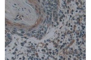 Immunohistochemistry (IHC) image for anti-Lymphotoxin beta Receptor (TNFR Superfamily, Member 3) (LTBR) (AA 66-215) antibody (ABIN7437122)
