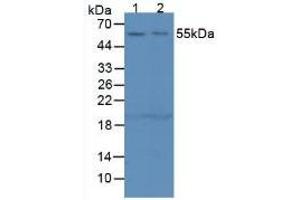Figure. (SERPING1 Antikörper  (AA 211-331))