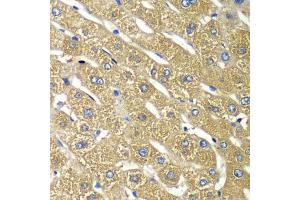 Immunohistochemistry of paraffin-embedded human liver injury using TMED10 Antibody (ABIN5974099) at dilution of 1/100 (40x lens). (TMED10 Antikörper)