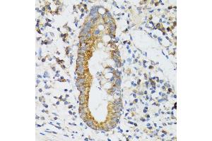 Immunohistochemistry of paraffin-embedded human vermiform appendix using SRP19 antibody (ABIN2560139) at dilution of 1:100 (40x lens). (SRP19 Antikörper)