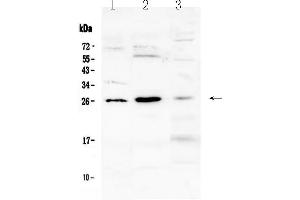 Western blot analysis of Flt3 ligand using anti-Flt3 ligand antibody . (FLT3LG Antikörper  (AA 28-189))