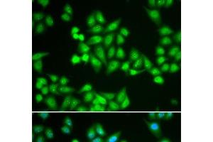 Immunofluorescence analysis of HeLa cells using CHD2 Polyclonal Antibody (CHD2 Antikörper)