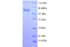 Vimentin (VIM) (AA 2-466) protein (His tag) expressed in E. (Vimentin Protein (VIM) (AA 2-466) (His tag))