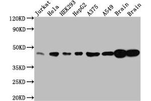 Western Blot Positive WB detected in: Jurkat whole cell lysate, Hela whole cell lysate, HEK293 whole cell lysate, HepG2 whole cell lysate, A375 whole cell lysate, A549 whole cell lysate, Rat Brain whole cell lysate, Mouse Brain whole cell lysate All lanes: ERK2 antibody at 1:1000 Secondary Goat polyclonal to rabbit IgG at 1/50000 dilution Predicted band size: 42, 37 kDa Observed band size: 42 kDa (Rekombinanter ERK2 Antikörper)