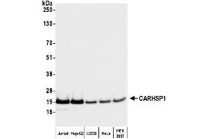 anti-Calcium Regulated Heat Stable Protein 1, 24kDa (CARHSP1) (AA 1-50) antibody
