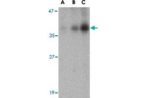 Western blot analysis of DFFB in Jurkat cell lysate with DFFB polyclonal antibody  at (A) 0. (DFFB Antikörper  (AA 203-218))