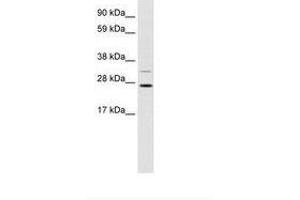 Image no. 1 for anti-DNA repair and recombination protein RAD54B (RAD54B) (AA 76-125) antibody (ABIN202190) (RAD54B Antikörper  (AA 76-125))