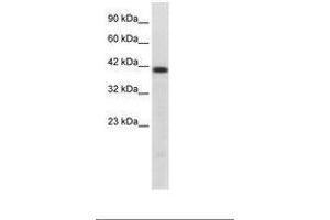Image no. 1 for anti-HNF1 Homeobox B (HNF1B) (AA 43-92) antibody (ABIN202427) (HNF1B Antikörper  (AA 43-92))