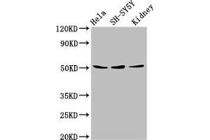Western Blot Positive WB detected in: Hela whole cell lysate, SH-SY5Y whole cell lysate, Mouse kidney tissue All lanes: RARG antibody at 8 μg/mL Secondary Goat polyclonal to rabbit IgG at 1/50000 dilution Predicted band size: 51, 50, 43, 48 kDa Observed band size: 51 kDa (Retinoic Acid Receptor gamma Antikörper  (AA 13-87))