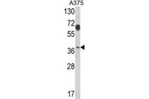 Western Blotting (WB) image for anti-Proteasome (Prosome, Macropain) 26S Subunit, Non-ATPase, 7 (PSMD7) antibody (ABIN3001710) (PSMD7 Antikörper)