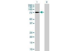 Lane 1: HP1BP3 transfected lysate ( 61. (HP1BP3 293T Cell Transient Overexpression Lysate(Denatured))