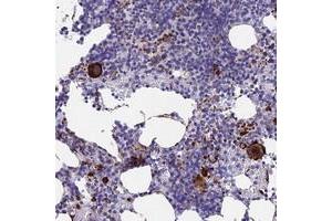 Immunohistochemical staining of human bone marrow with C15orf59 polyclonal antibody  shows strong cytoplasmic positivity in megakaryocytes at 1:500-1:1000 dilution. (C15ORF59 Antikörper)