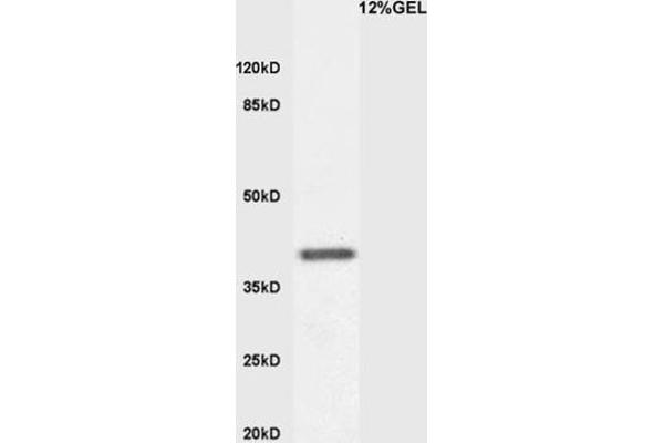 KLF2 Antikörper  (AA 251-355)