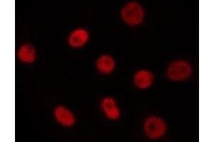 ABIN6275620 staining Hela by IF/ICC. (T-Box 18 Antikörper  (Internal Region))