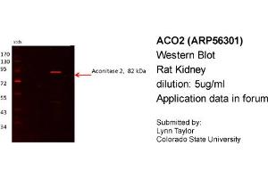 Western Blotting (WB) image for anti-Aconitase 2, Mitochondrial (ACO2) (N-Term) antibody (ABIN2786627) (ACO2 Antikörper  (N-Term))