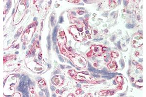 Immunohistochemistry (IHC) image for anti-Solute Carrier Family 38 Member 3 (SLC38A3) (N-Term) antibody (ABIN2775351)