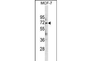 ATG13 Antibody (Center . (ATG13 Antikörper  (AA 333-362))